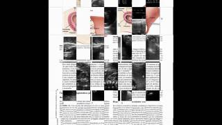 Libro de Ecografía Obstétrica y Ginecológica [upl. by Lyret39]