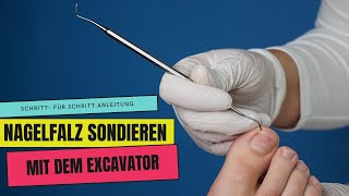 NAGELFALZ sondieren und reinigen mit dem ECKENHEBEREXCAVATOR [upl. by Amliv]