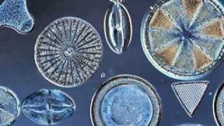 Beautiful Diatoms [upl. by Adnorat]