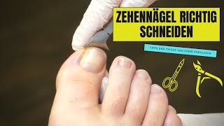 ZEHENNÄGEL RICHTIG SCHNEIDEN  So geht es richtig [upl. by Erroll]