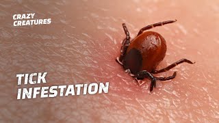 WARNING The Most Horrific Tick Infestations [upl. by Sayres]