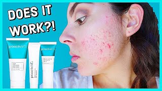 Does Proactiv MD Really Work Honest 2 Month Review [upl. by Hartley]