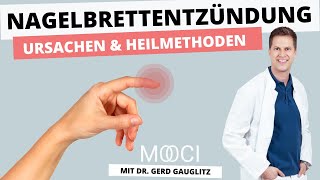 Was tun bei Nagelbettentzündung  10 Fragen an PD Dr med Gerd Gauglitz  MOOCI [upl. by Nileuqaj]