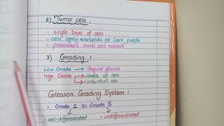 Prostate Carcinoma Pathology  Morphology and Gleason Grading [upl. by Cagle]