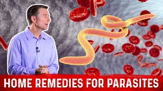 Best Home Remedies for Parasites – Dr Berg [upl. by Norling]