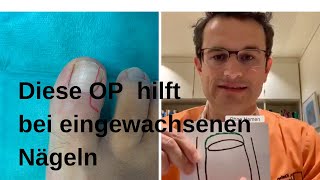 Hilfe bei eingewachsenen Zehenägeln [upl. by Werra]