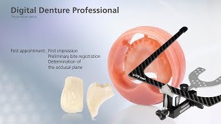 Digital Denture – first Appointment [upl. by Ilonka]