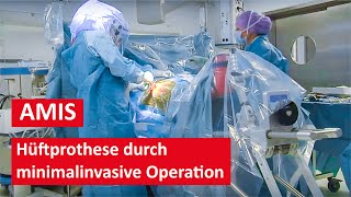 Hüftprothese durch minimalinvasive AMIS Methode  Live Operation [upl. by Kcirdle720]