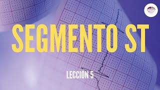 5 ELECTOCARDIOGRAMA SEGMENTO ST ELECTROCARDIOGRAFÍA [upl. by Noram565]