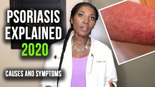 Psoriasis Explained  Psoriasis Causes and Symptoms 2020 [upl. by Tol]