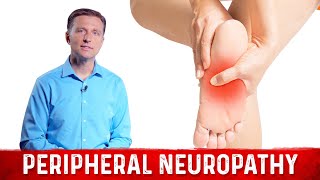 How to Relieve Peripheral Neuropathy Pain – Dr Berg [upl. by Leanard]