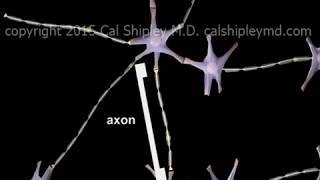 Traumatic Brain Injury  Diffuse Axonal Injury DAI  Animation by Dr Cal Shipley MD [upl. by Lacsap88]