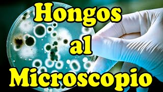 Observando HONGOS al MICROSCOPIO [upl. by Niamert455]