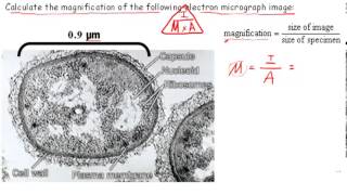 Calculating Magnification IB Biology [upl. by Umeh]