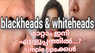 how to remove blackheads and whiteheads at home in malayalam in Naturally zerahmalayalam [upl. by Assennej250]