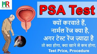 PSA  prostate specific antigen  test in hindi  PSA test normal range  PSA test क्या होता है [upl. by Dukie]