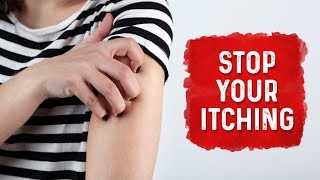 What Causes Hives and Itchiness  Urticaria Hives Treatment  Dr Berg [upl. by Greiner]