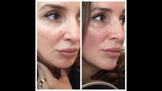 Facial Lifting amp Toning with Microcurrent at home [upl. by Ynamad]