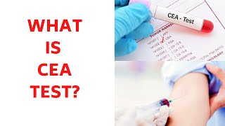 WHAT IS CEA BLOOD TEST Carcinoembryonic Antigen Test Levels CEA Blood Test Meaning [upl. by Gahan]