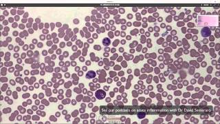 What blood looks like down the microscope [upl. by Arakaj]