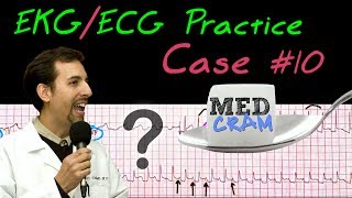 12 Lead ECG Practice Strip Interpretation  EKG Case 10 [upl. by Aitnyc]